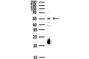 anti-Tachykinin Receptor 1 (TACR1) (Internal Region) antibody