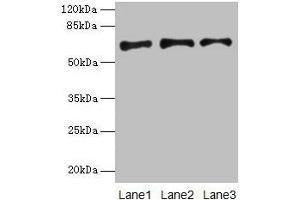 Western blot All lanes: PLAT antibody at 16 μg/mL Lane 1: Jurkat whole cell lysate Lane 2: Mouse stomach tissue Lane 3: Mouse kidney tissue Secondary Goat polyclonal to rabbit IgG at 1/10000 dilution Predicted band size: 63, 33, 58, 45 kDa Observed band size: 63 kDa (PLAT Antikörper  (AA 36-556))