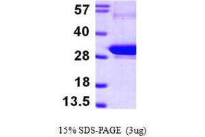 SDS-PAGE (SDS) image for RAB5B, Member RAS Oncogene Family (RAB5B) (AA 1-215) protein (His tag) (ABIN667307)