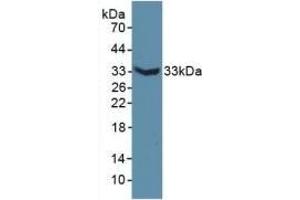 Detection of Recombinant MAP6, Mouse using Polyclonal Antibody to Microtubule Associated Protein 6 (MAP6) (MAP6 Antikörper  (AA 177-387))