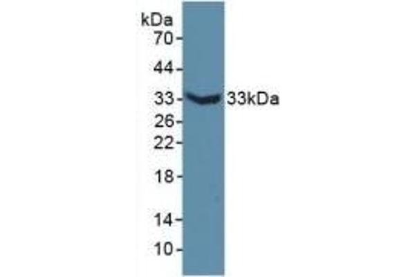 MAP6 Antikörper  (AA 177-387)