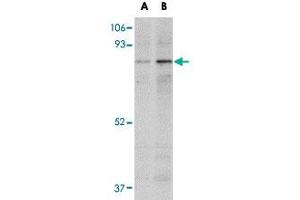 Western blot analysis of NAA35 in mouse heart tissue lysate with NAA35 polyclonal antibody  at (A) 1 and (B) 2 ug/mL . (MAK10/NAA35 Antikörper  (Internal Region))