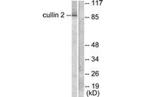 Western blot analysis of extracts from LOVO cells, using Cullin 2 Antibody. (Cullin 2 Antikörper  (AA 696-745))