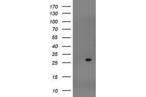Western Blotting (WB) image for anti-Suppressor of Cytokine Signaling 3 (SOCS3) antibody (ABIN1501053)