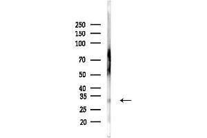 anti-Charged Multivesicular Body Protein 2B (CHMP2B) (C-Term) antibody