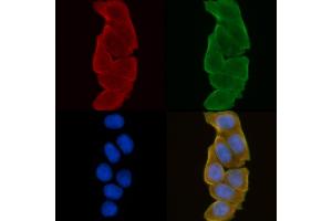 ABIN6258962 and ABIN6275051 staining Hela cells(30 min of UV treatment) by IF/ICC. (PLA2G4C Antikörper  (Internal Region))