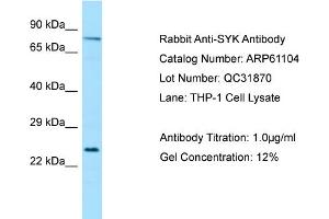 Western Blotting (WB) image for anti-Spleen tyrosine Kinase (SYK) (Middle Region) antibody (ABIN971831) (SYK Antikörper  (Middle Region))