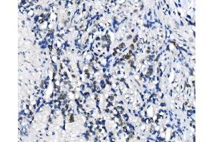 IHC analysis of METTL3 using anti-METTL3 antibody (ABIN7602808).