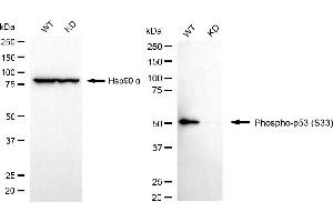Western blotting analysis using phospho-p53 (S33) antibody (ABIN7800680).