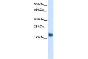 Western Blotting (WB) image for anti-Cysteine and Glycine-Rich Protein 3 (CSRP3) antibody (ABIN2460885) (CSRP3 Antikörper)