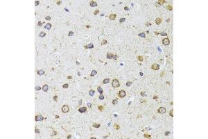 Immunohistochemistry of paraffin-embedded mouse brain using  antibody (ABIN6129960, ABIN6136680, ABIN6136681 and ABIN6224707) at dilution of 1:100 (40x lens). (AIFM3 Antikörper  (AA 1-200))