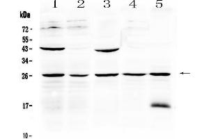 Western blot analysis of Noggin using anti-Noggin antibody . (NOG Antikörper  (AA 43-153))
