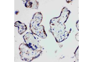 Anti-HSD17B1 antibody, IHC(P): Human Placenta Tissue (HSD17B1 Antikörper  (N-Term))