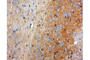 IHC-P analysis of Brain tissue, with DAB staining. (ACP5 Antikörper  (AA 79-318))
