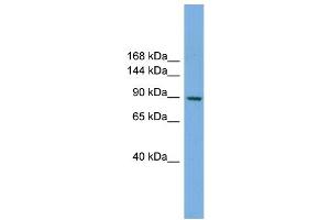 WB Suggested Anti-RAPGEF3 Antibody Titration: 0. (RAPGEF3 Antikörper  (N-Term))