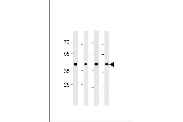 CABLES2 Antikörper  (AA 182-210)