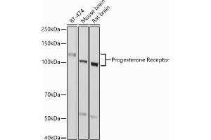Western blot analysis of extracts of various cell lines, using Progesterone Receptor antibody (ABIN6128570, ABIN6145518, ABIN6145519 and ABIN6213802) at 1:1000 dilution. (Progesterone Receptor Antikörper  (AA 1-250))