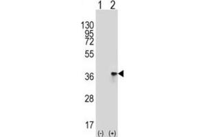 Western Blotting (WB) image for anti-Toll Interacting Protein (TOLLIP) antibody (ABIN3001486)