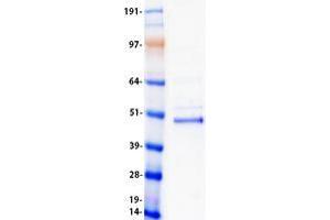 Validation with Western Blot (VSX2 Protein (Myc-DYKDDDDK Tag))