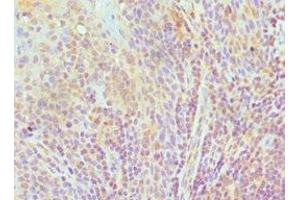 Immunohistochemistry of paraffin-embedded human tonsil tissue using ABIN7151592 at dilution of 1:100 (TCEB3 Antikörper  (AA 679-798))