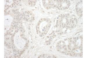 anti-Importin 4 (IPO4) (AA 350-400) antibody