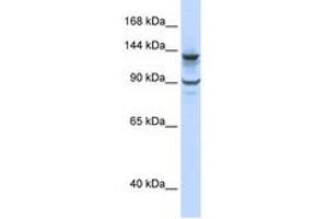 Image no. 1 for anti-PiggyBac Transposable Element Derived 1 (PGBD1) (N-Term) antibody (ABIN6742645)