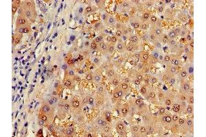 Immunohistochemistry of paraffin-embedded human liver tissue using ABIN7144595 at dilution of 1:100 (ASL Antikörper  (AA 2-300))