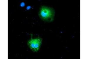 Anti-CALCOCO2 mouse monoclonal antibody (ABIN2454024) immunofluorescent staining of COS7 cells transiently transfected by pCMV6-ENTRY CALCOCO2 (RC203843). (CALCOCO2 Antikörper)