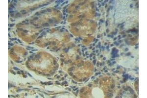 Immunohistochemistry (IHC) image for anti-P-Cadherin (CDH3) (AA 371-660) antibody (ABIN7437923)