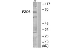 Western blot analysis of extracts from Jurkat cells, using FZD8 Antibody. (FZD8 Antikörper  (AA 31-80))