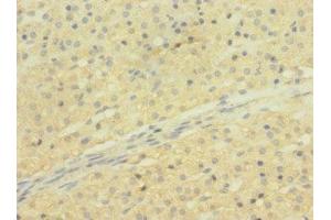 Immunohistochemistry (IHC) image for anti-Solute Carrier Organic Anion Transporter Family, Member 2B1 (SLCO2B1) (AA 130-210) antibody (ABIN7170303)