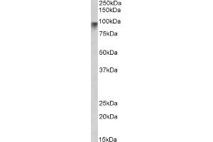 ABIN190848 (2µg/ml) staining of Human Pancrease lysate (35µg protein in RIPA buffer). (Neuroligin 2 Antikörper  (Internal Region))