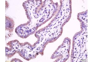 paraformaldehyde-fixed, paraffin embedded mouse placenta tissue, Antigen retrieval by boiling in sodium citrate buffer(pH6) for 15min, Block endogenous peroxidase by 3% hydrogen peroxide for 30 minutes, Blocking buffer (normal goat serum) at 37°C for 20min, Antibody incubation with Rabbit Anti-Integrin alpha 5 Polyclonal Antibody, Unconjugated  at 1:400 overnight at 4°C, followed by a conjugated secondary and DAB staining (ITGA5 Antikörper  (AA 1021-1099))