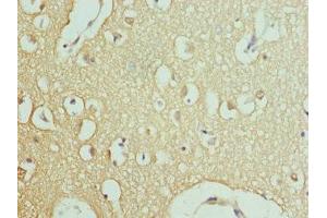Immunohistochemistry of paraffin-embedded human brain tissue using ABIN7167017 at dilution of 1:100 (RPH3A Antikörper  (AA 1-280))