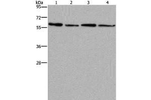 Western Blot analysis of Mouse kidney, liver, heart and brain tissue using CD297 Polyclonal Antibody at dilution of 1:667 (ART4 Antikörper)