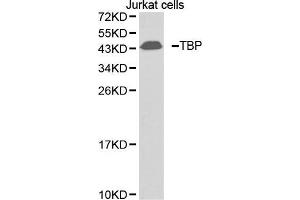 Western blot analysis of extracts of Jurkat cell lines, using TBP antibody. (TBP Antikörper  (AA 1-100))