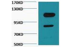 Western Blot (WB) analysis of Jurkat, diluted at 1:3000. (PARP1 Antikörper  (cleaved))