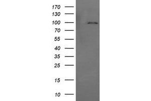 Image no. 2 for anti-Phosphoinositide-3-Kinase, Regulatory Subunit 5 (PIK3R5) antibody (ABIN1500212) (PIK3R5 Antikörper)