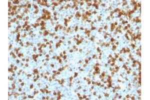 Formalin-fixed, paraffin-embedded human Tonsil stained with PD1 (CD279) Rabbit Recombinant Monoclonal Antibody (PDCD1/1410R). (Rekombinanter PD-1 Antikörper)