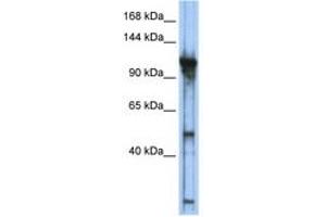 Image no. 1 for anti-General Transcription Factor IIIC, Polypeptide 2, beta 110kDa (GTF3C2) (AA 755-804) antibody (ABIN6742236) (GTF3C2 Antikörper  (AA 755-804))