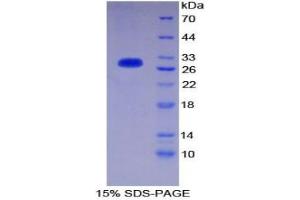 SDS-PAGE analysis of Mouse CD1d Protein. (CD1d Protein)
