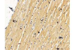 ENTPD6 Antibody at 1/100 staining rat heart tissue by IHC-P.