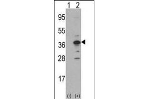 Western blot analysis of MCA1(arrow) using rabbit polyclonal MCA1 Antibody (N-term) (ABIN390679 and ABIN2840973). (MCA1 Antikörper  (C-Term))