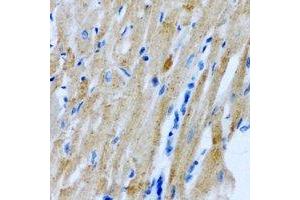 Immunohistochemical analysis of Myomegalin staining in rat heart formalin fixed paraffin embedded tissue section. (PDE4DIP Antikörper)