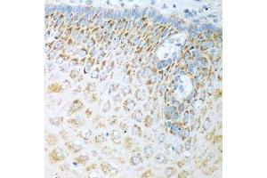 Immunohistochemistry (Paraffin-embedded Sections) (IHC (p)) image for anti-Ferredoxin Reductase (FDXR) (AA 252-491) antibody (ABIN1679833)
