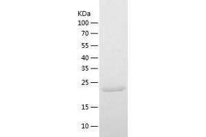 Western Blotting (WB) image for Fibroblast Growth Factor 9 (FGF-9) (AA 3-208) protein (His tag) (ABIN7122952) (FGF9 Protein (AA 3-208) (His tag))
