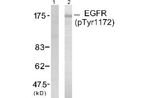 Western blot analysis of extracts from A431 cells untreated or treated with EGF (40μM, 10mins), using EGFR (phospho-Tyr1172) antibody (Linand 2).