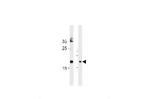 FA Antibody (Center) (ABIN1881332 and ABIN2843378) western blot analysis in Hela cell line and mouse bladder tissue lysates (35 μg/lane). (FAM159A Antikörper  (AA 89-115))