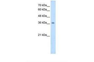 Image no. 1 for anti-Wingless-Type MMTV Integration Site Family, Member 16 (WNT16) (AA 270-319) antibody (ABIN320623)
