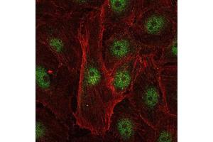 Immunofluorescence analysis of U251 cells using c-Rel mouse mAb (green).